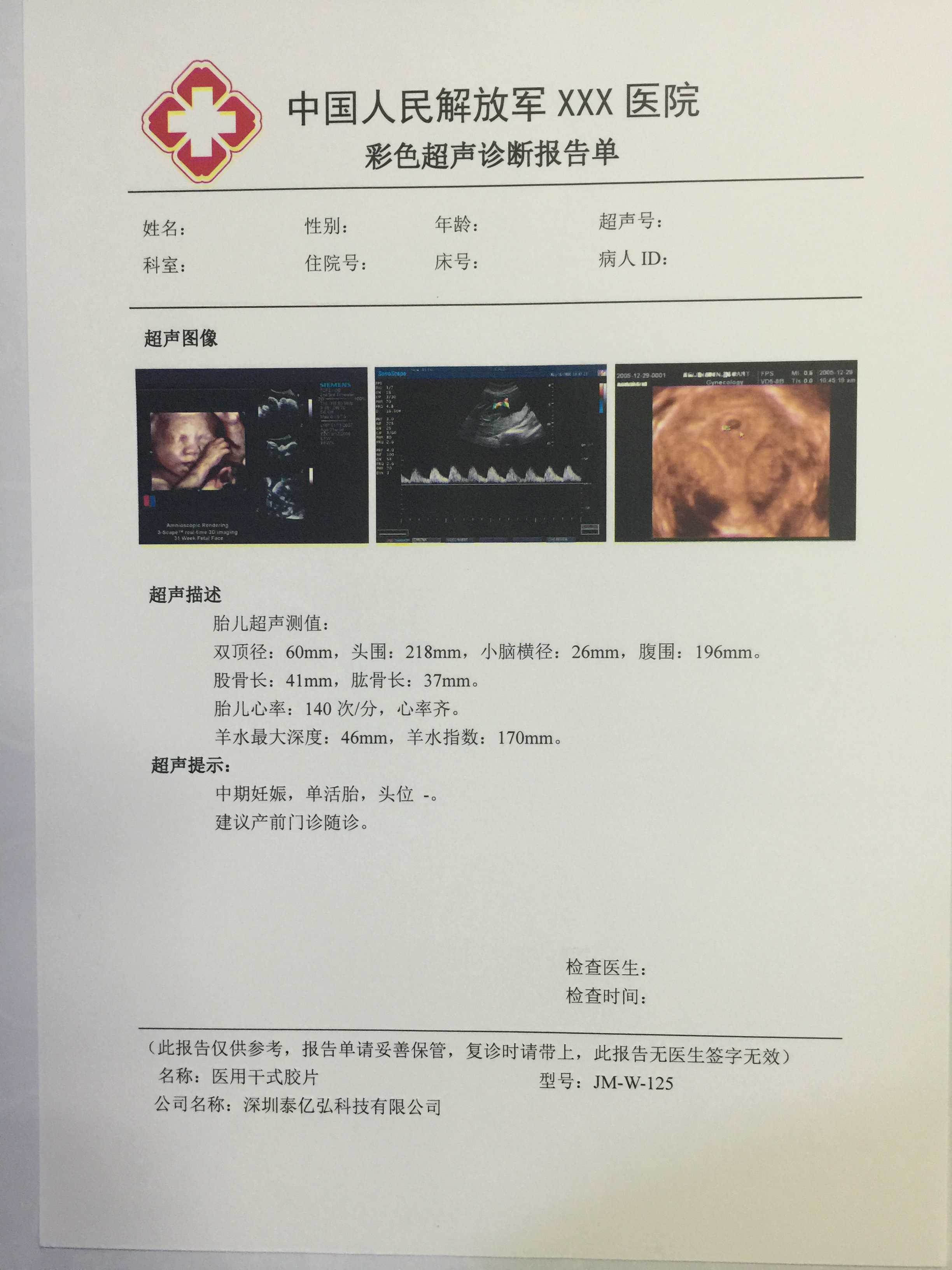 供应双面打印超声干式胶片医疗耗材X光图片