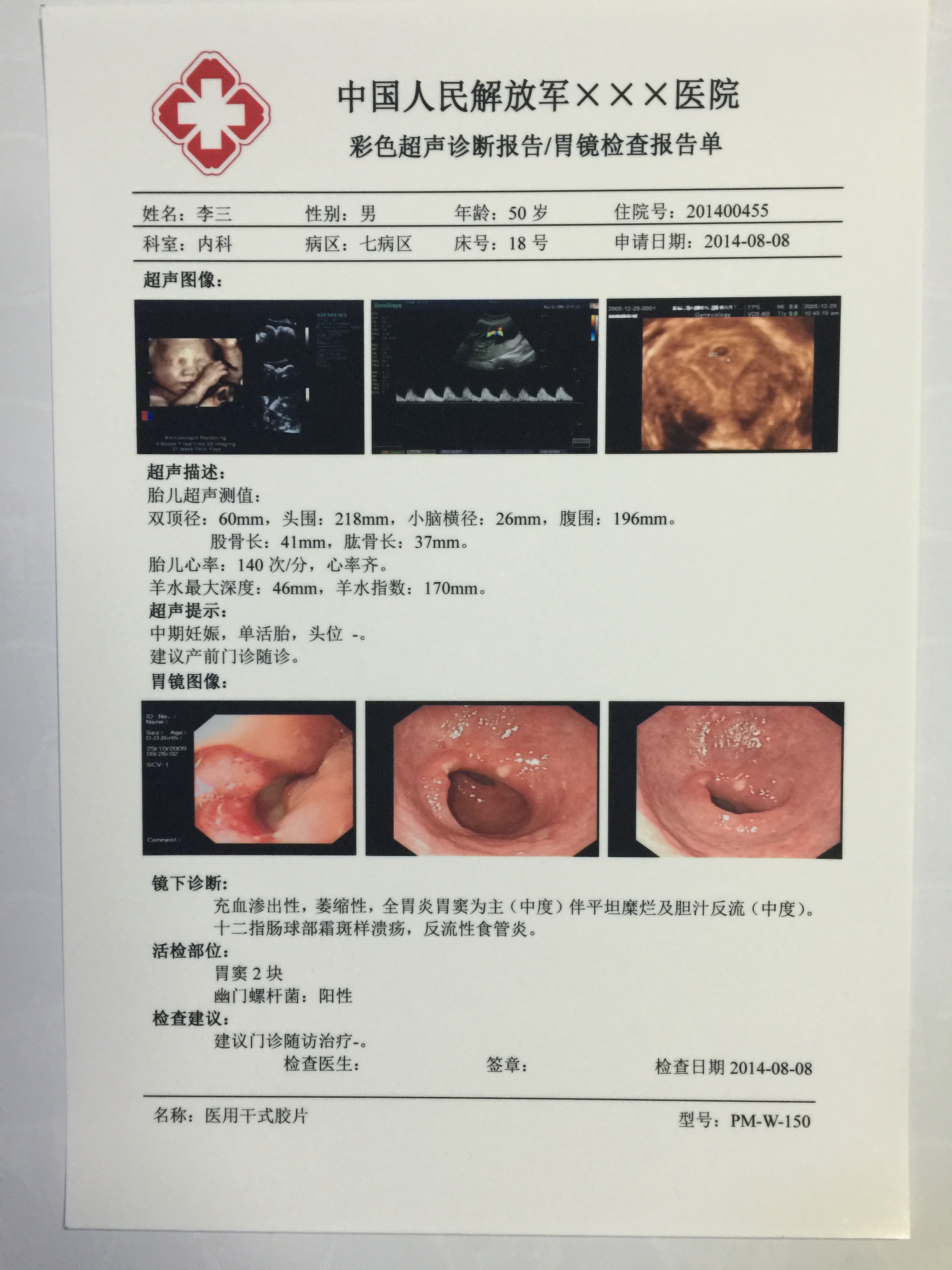 医用干式胶片超声打印胶片X光放射瓷白医用超声胶片喷墨打印胶片B5单面打印阴道镜胃镜TCT彩超PET胶片0.150厚图片