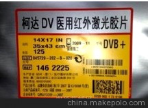 邢台市批发爱克发DT1B医用胶片厂家