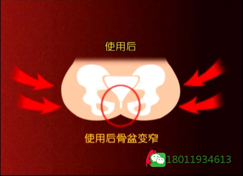 广州盆腔仪批发价 盆腔仪功效原理