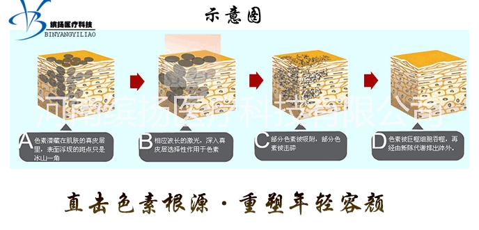 YAG光電調(diào)Q激光美容儀器圖片/YAG光電調(diào)Q激光美容儀器樣板圖 (4)