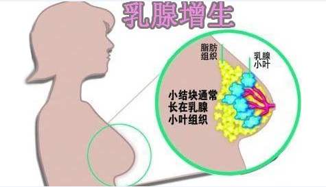 乳腺增生理疗贴价钱、效果怎么样、批发、供应商【上海比博升商贸发展有限公司】图片