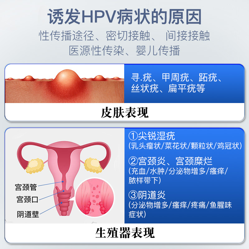 长沙市抗HPV卡波姆妇科阻菌凝胶厂家