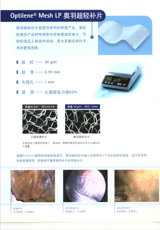 上海市贝朗疝补片厂家贝朗疝补片 腹部疝修补术