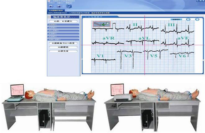 高智能数字网络化心电图模拟教学系统GD/ZXD1900（教师机）图片