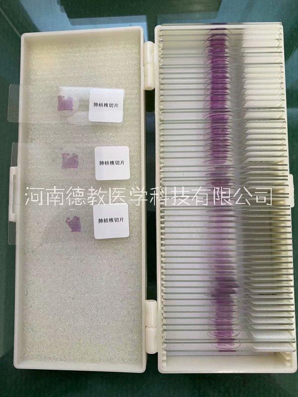 漯河市河南德教生物标本切片模型厂生物切片病理切片大叶性肺炎形态学基础医学教学切片厂家