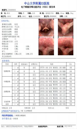 喉镜吞咽评估工作站图片