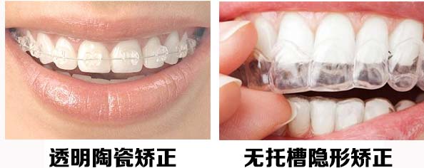 供應(yīng)用于牙齒矯正的鄭州矯正牙齒有哪些方法?