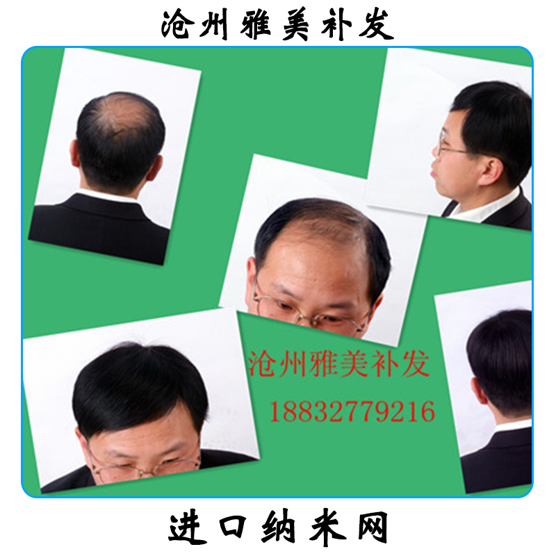 進(jìn)口納米網(wǎng) 真人發(fā)納米型發(fā)塊 透氣納米網(wǎng)無痕補(bǔ)發(fā)發(fā)塊 手織發(fā)塊