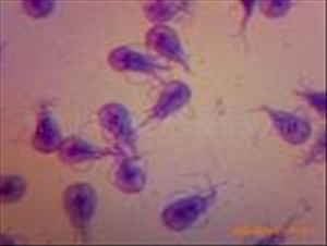 肝吸蟲生活史是怎么樣的  肝吸蟲生活史過程