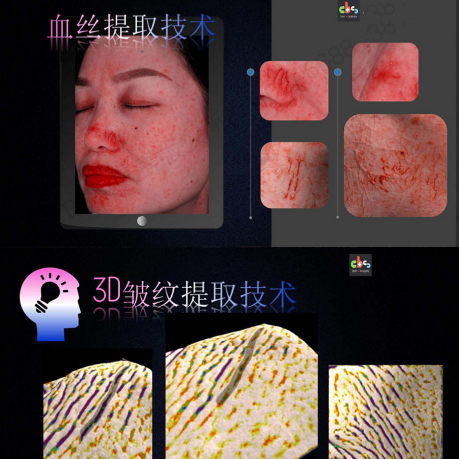 2400萬 CBS面部皮膚斷點(diǎn)掃描儀，魔鏡檢測儀器，新功能魔鏡儀
