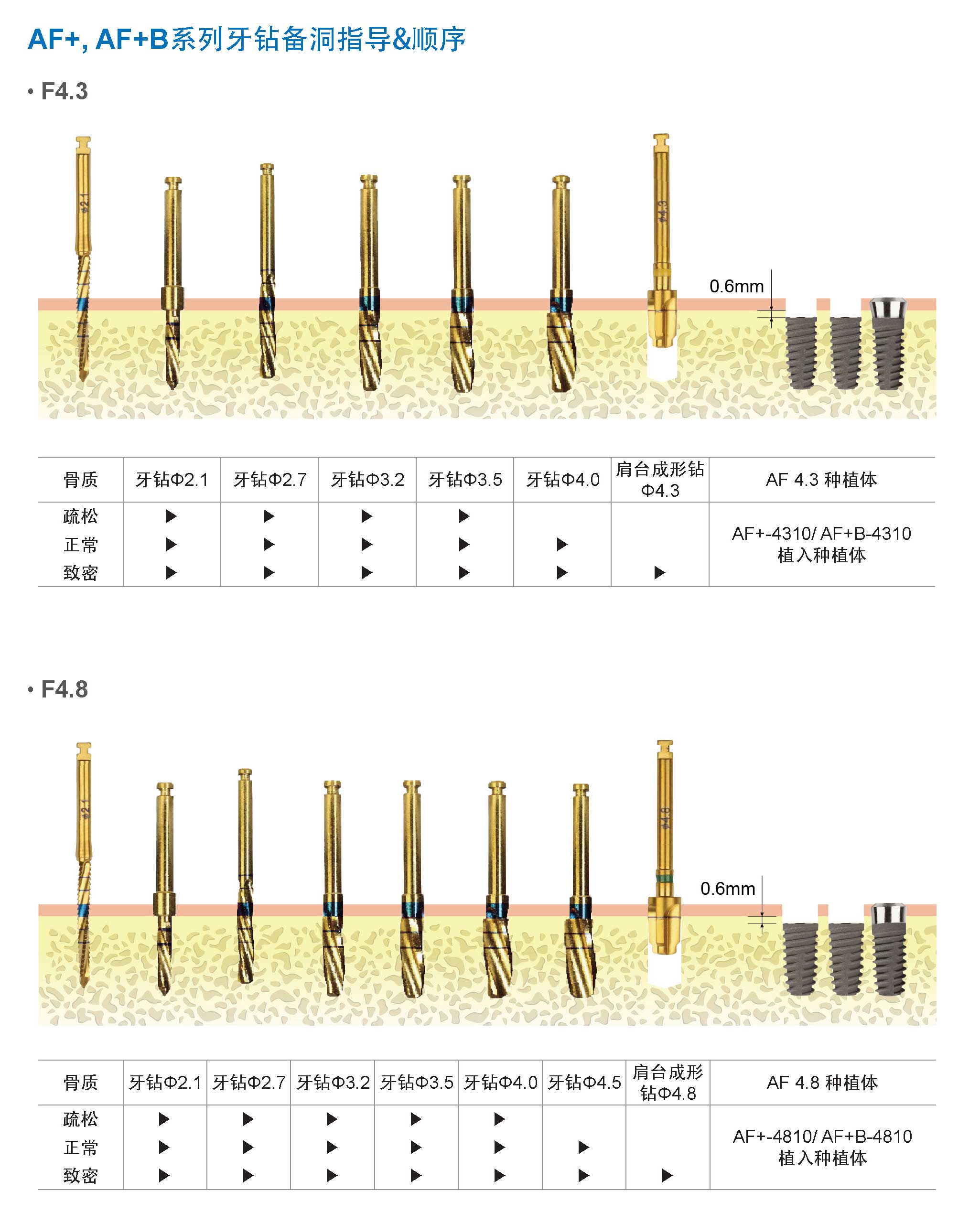 備洞指導(dǎo)流程
