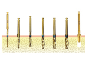 備洞指導(dǎo)流程