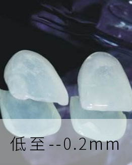 牙縫大的主流修復(fù)方式 牙齒貼面