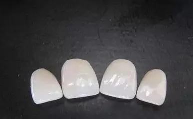 了解牙齒美學(xué)標(biāo)準(zhǔn)與洗牙 齒哈尼 美牙貼 牙齒美白