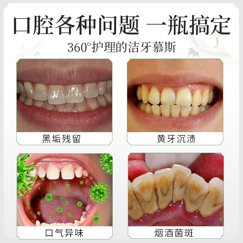 皓齒潔牙慕斯 潔白凈齒 清新口氣 護(hù)理口腔 定制代工