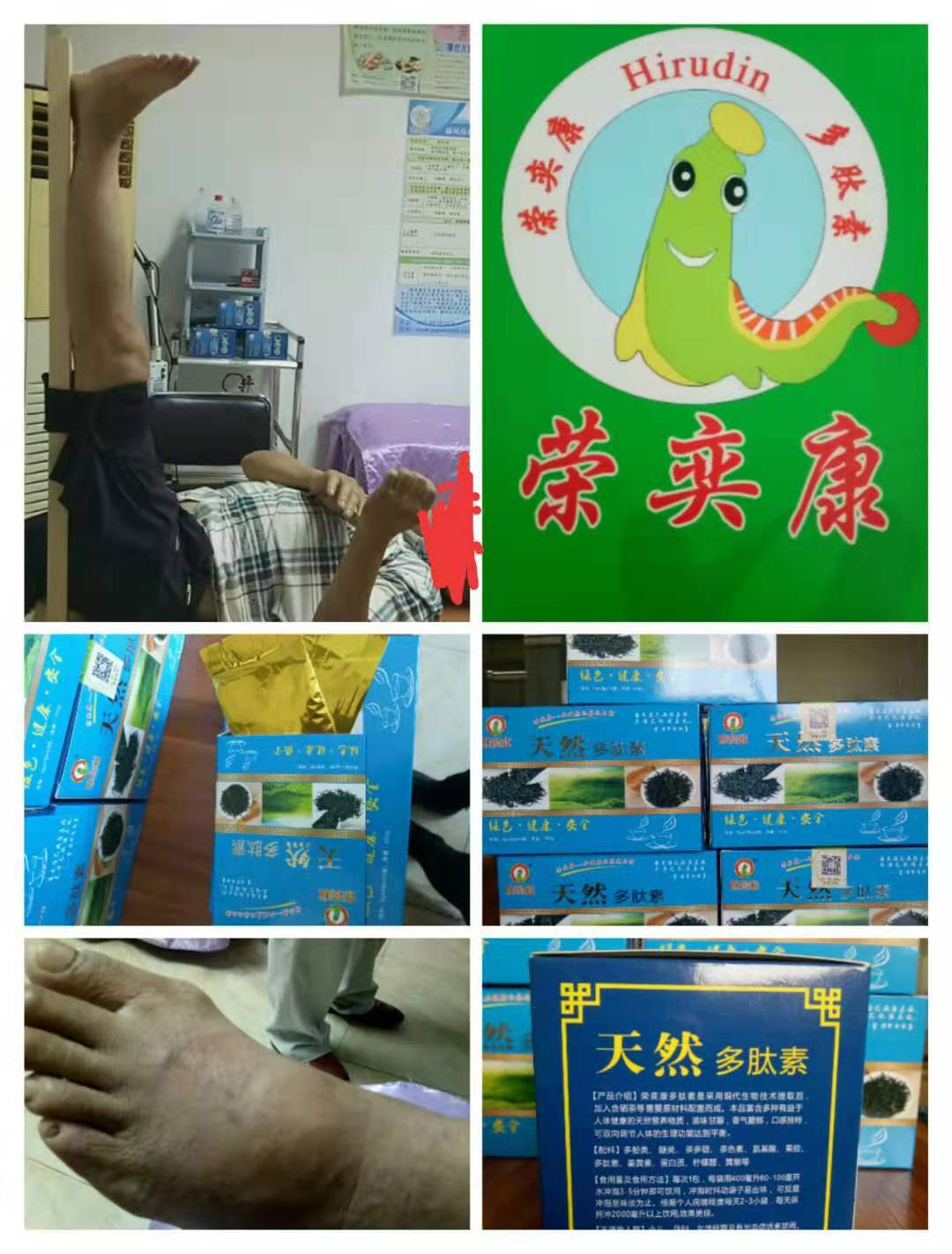 天然多肽素