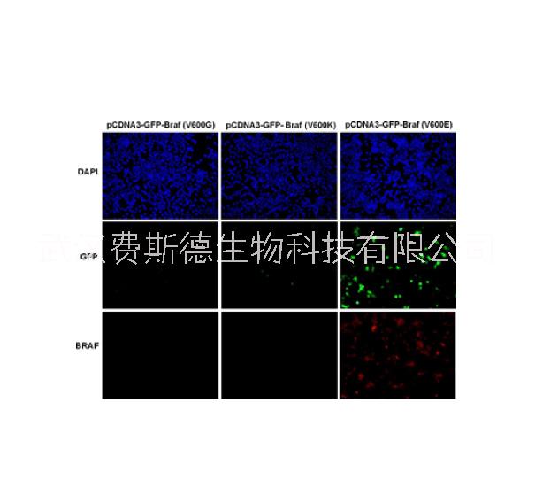 BRAF(V600M) 小鼠單抗/*點(diǎn)突變抗體/武漢費(fèi)斯德